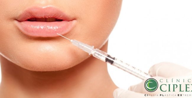 Relleno de labios todo lo que necesitas saber