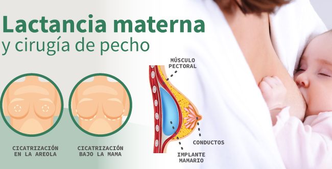 Lactancia materna y cirugía de pecho resolvemos tus dudas